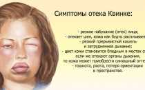 Wonderzine: Аллергия на чистоту?